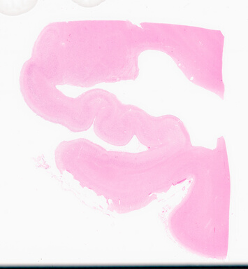['deident_afedc843-2e80-4d74-af32-7378f7bb31ec_695fcfc9.jpg']