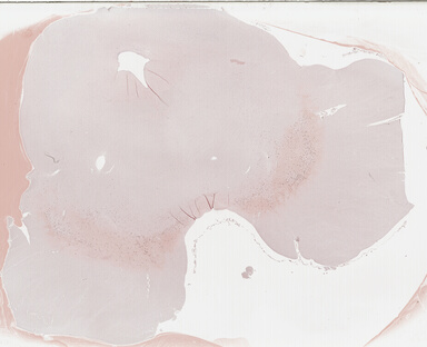 ['deident_bf10eeae-a746-462e-8ba6-0d6ddd9cb48d_69b0386e.jpg']