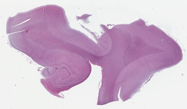 ['deident_8982ae5a-7410-43af-8d1a-92a2cc049f3c_69b03856.jpg']