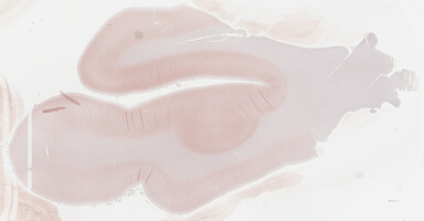 ['deident_11873f17-fc3f-44c1-b15e-fe6341498e59_69b03828.jpg']