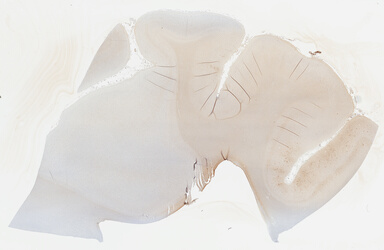 ['deident_f3282ad3-c84f-4bc2-be96-9ecdc30e48ec_69b03882.jpg']