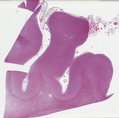 ['deident_25bfc726-ed29-47d3-bcd5-445f1f43183c_69b046ff.jpg']