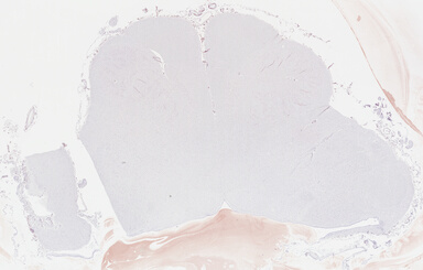 ['deident_c0351497-12d2-4719-82e2-b0d39b63c77f_69b0472c.jpg']