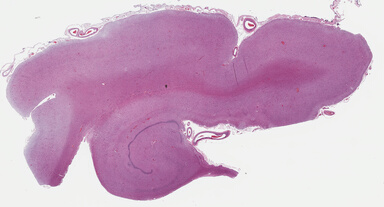 ['deident_cdcd4d15-1f96-406d-9989-55fd44b27568_69b04730.jpg']