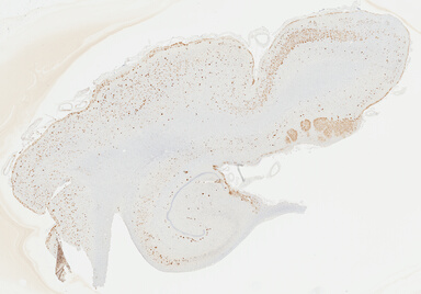 ['deident_dc90a022-43f1-40f3-9f31-12ac58d865cb_69b04734.jpg']