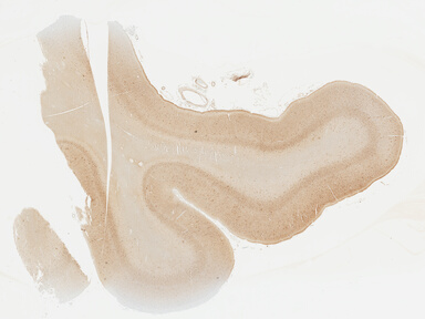 ['deident_750da124-3c08-4f04-9e41-a3b234260e17_69b04718.jpg']