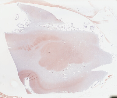 ['deident_4f60caf3-5640-4fef-87f2-5abb919147ce_69b0470a.jpg']