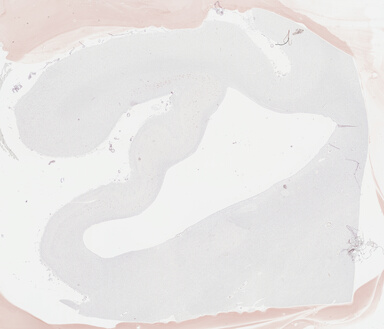 ['deident_0ec558e5-c311-410c-9800-1bc4ca2b1f63_69b046e8.jpg']