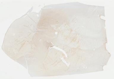 ['deident_44e12805-5987-431b-8a40-d14e5791be69_69b04705.jpg']