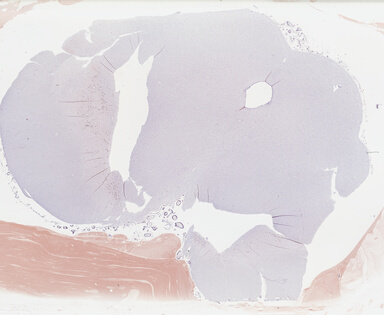 ['deident_1d48d728-e470-459c-b360-aebf8b28868b_69b046f8.jpg']
