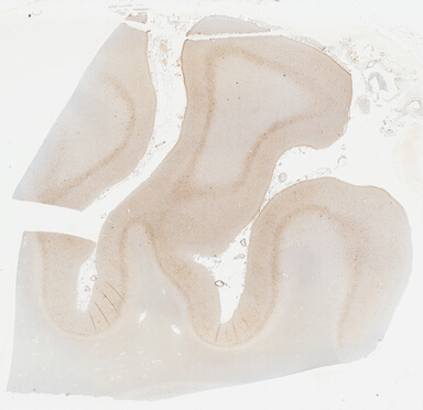 ['deident_207e54a6-9e0d-42df-8876-45b45ee52202_69b046fd.jpg']