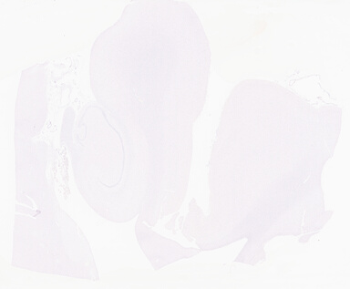 ['deident_4bdf5cfd-9f7b-4566-a5b5-17048cde7b05_69d95569.jpg']