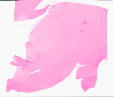 ['deident_66ec773f-6668-42ce-99b8-628b0fa87eea_69d95592.jpg']