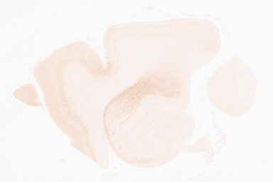 ['deident_4a9c398a-02c3-460a-adf9-38c1eb9bbe1c_69d9554d.jpg']
