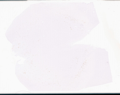 ['deident_5d8429b1-a10e-4645-9cba-2ab3d320ef7e_69d9558f.jpg']