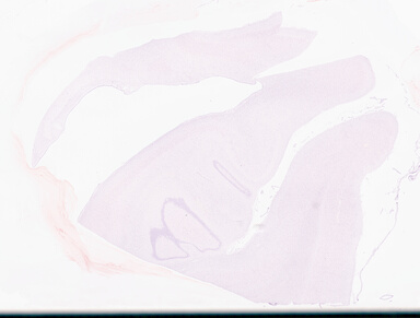 ['deident_7de5982f-ff2b-47b4-ba28-9cd4e42b9601_69d9559b.jpg']
