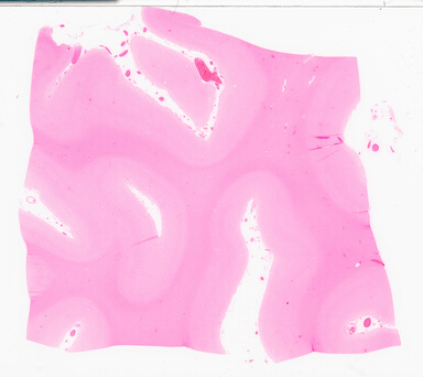 ['deident_c1acfc74-f4f1-459d-9d7c-e21d40b4f64d_69d955bc.jpg']