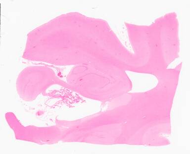 ['deident_8877d65a-0ca3-46f2-908f-99d0860be505_69d9559d.jpg']