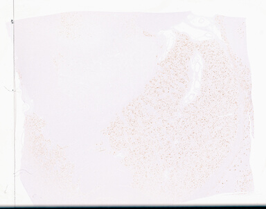 ['deident_4a8883b2-124a-4084-89a8-31af0f887aaf_69d9554b.jpg']