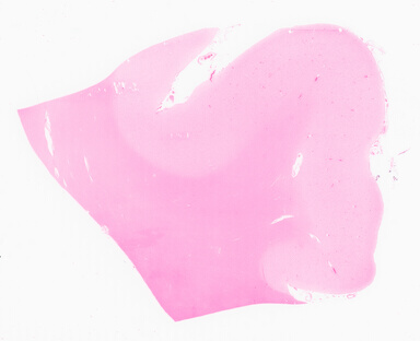 ['deident_a9a28b76-c5d3-46ed-8c0b-d462757f6d69_69d955b3.jpg']