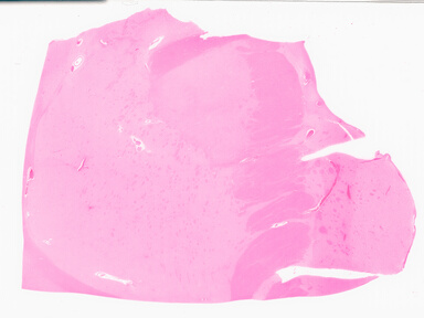['deident_9f848ff6-ef69-4f0f-9578-ef500f27b180_69d955ae.jpg']