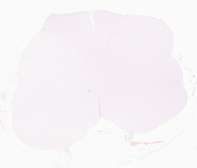['deident_052c9661-d3dc-4267-af5a-553a6118f11e_69d9551c.jpg']