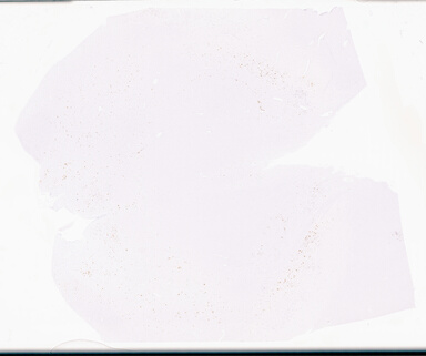 ['deident_2c02fbef-fbe8-4ddb-a8ab-fc112898a84e_69d9553b.jpg']