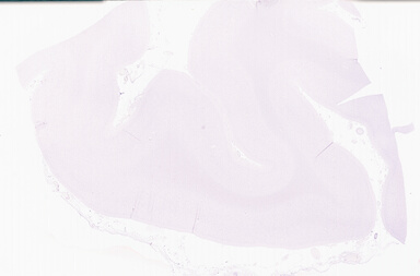 ['deident_97184fec-9a49-4bd4-9003-2debf8d7f2d7_69d955aa.jpg']