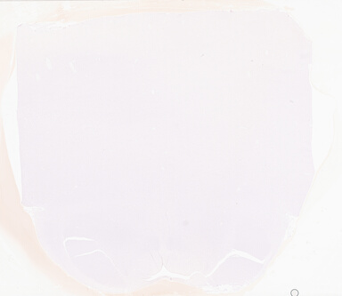 ['deident_3063f25d-9433-4ecd-8de4-ae10d0d42831_69d95540.jpg']