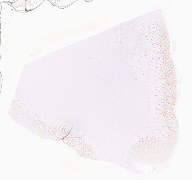 ['deident_f9cc6aed-2c70-4788-aaf3-5b6140461f4c_69d955d8.jpg']