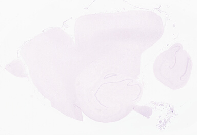 ['deident_4e4b9fbc-367e-4a8d-a693-1984715ac952_69d9557d.jpg']