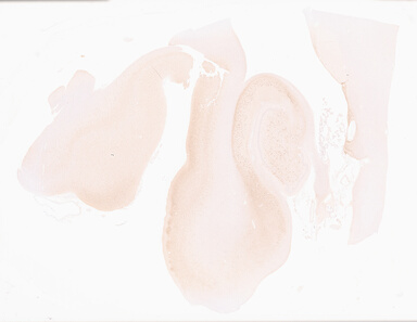['deident_b23b024d-feaf-451a-be81-90fd96f58f0f_69d955b5.jpg']