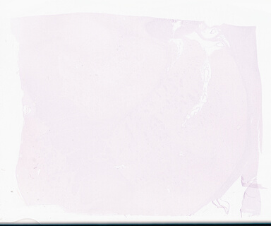 ['deident_2e2d60be-a69d-4fb9-a772-66887a136628_69d9553e.jpg']