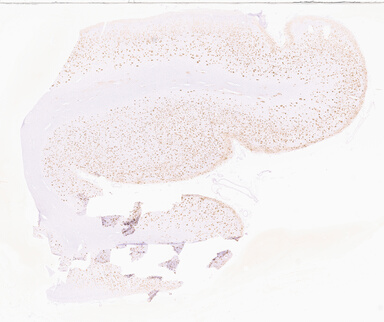 ['deident_a89e1849-4108-4a4c-92b0-846515e830fa_69d955b2.jpg']