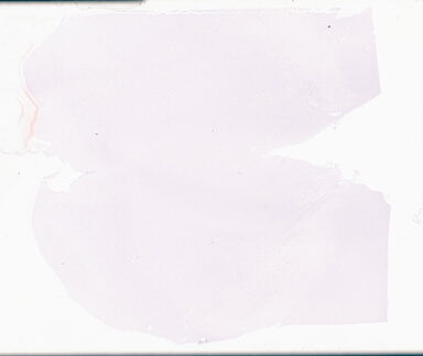 ['deident_905ffd32-3db1-4ed0-a24b-494158364cf5_69d955a4.jpg']