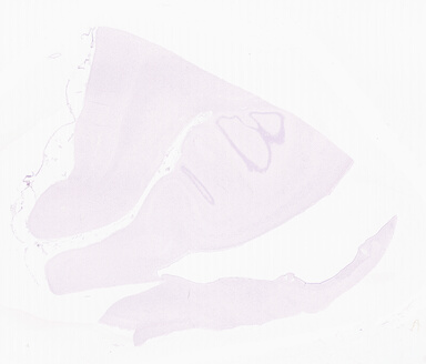 ['deident_17d5eed8-8be6-47c9-9a41-c5e2d17b7928_69d9552a.jpg']
