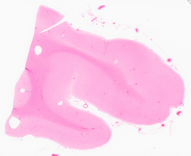 ['deident_e37f20f5-68f5-47d2-8b6a-081dd324a5a9_69d955d3.jpg']
