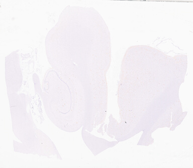 ['deident_55f1946b-9011-4d24-bc8d-6a3567fc9b66_69d95589.jpg']