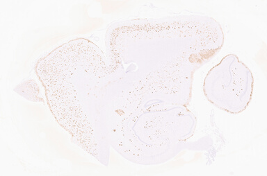 ['deident_47a7bd97-3391-4a85-9e41-d3a4331b3d6b_69d95549.jpg']