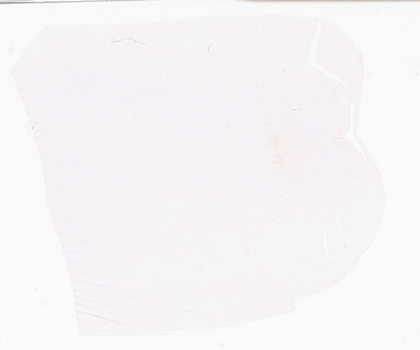 ['deident_38a7745a-7933-4690-bfe9-e9d8d13ce109_69d95547.jpg']