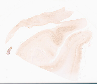 ['deident_dd30e08c-668d-4b0d-a671-8930d8d99c5a_69d955ce.jpg']