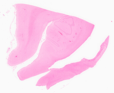 ['deident_a3f8885a-8398-46e8-8b6b-0627e22c73a6_69d955b0.jpg']