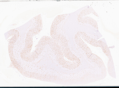 ['deident_bacba9c8-925b-45fe-a429-a3913d9da648_69d955ba.jpg']