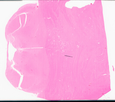 ['deident_c67f1190-02a7-44c9-91ce-145f88f1b038_69d955be.jpg']