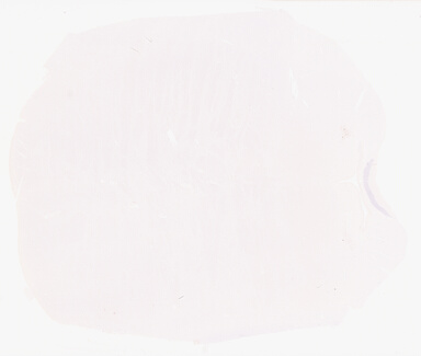 ['deident_a328902f-8e5a-4ef9-a5ce-217ec39010ba_69b05fab.jpg']