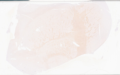 ['deident_b9d35fb0-5967-4094-a29b-3cb5dda7aba9_69b05fb3.jpg']