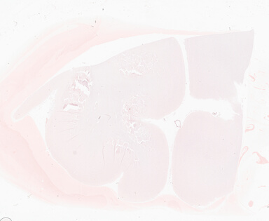 ['deident_779e737c-b559-4c3c-82b5-3242e60c1450_69b05f8e.jpg']