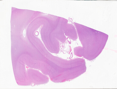['deident_97df37d7-16ec-49cc-a51d-2efa39e2b025_69b05fa8.jpg']