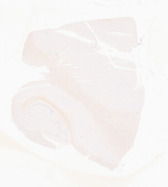 ['deident_dd16d6c7-8264-45cf-b00a-6a77b9af2919_69b05fc2.jpg']