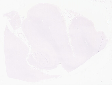 ['deident_660d93c3-0c67-43ed-a77e-6fc8d49269d1_69b05f86.jpg']